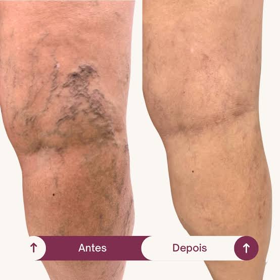 Transformação 1
